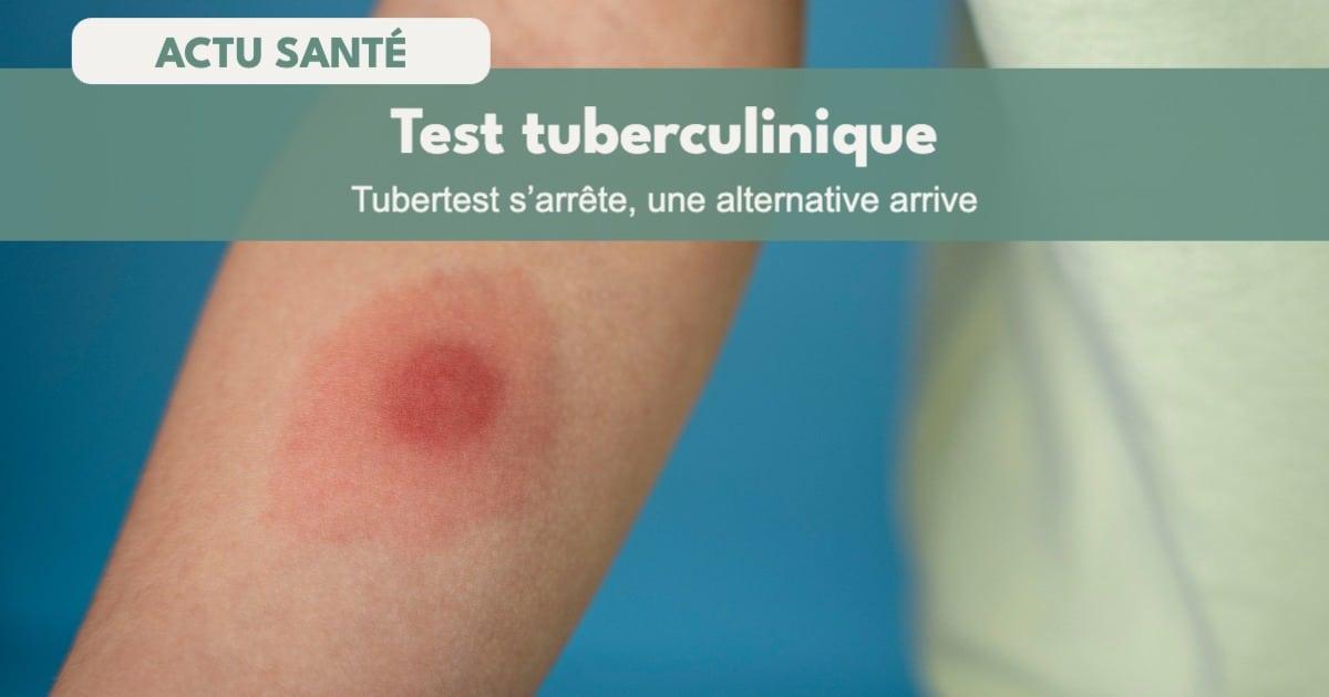 Vous devez realiser un test cutane a la tuberculine 1 942108675397355 - Accueil - Beg Meil Fouesnant Vous devez realiser un test cutane a la tuberculine 1 942108675397355 - Accueil - Beg Meil Fouesnant